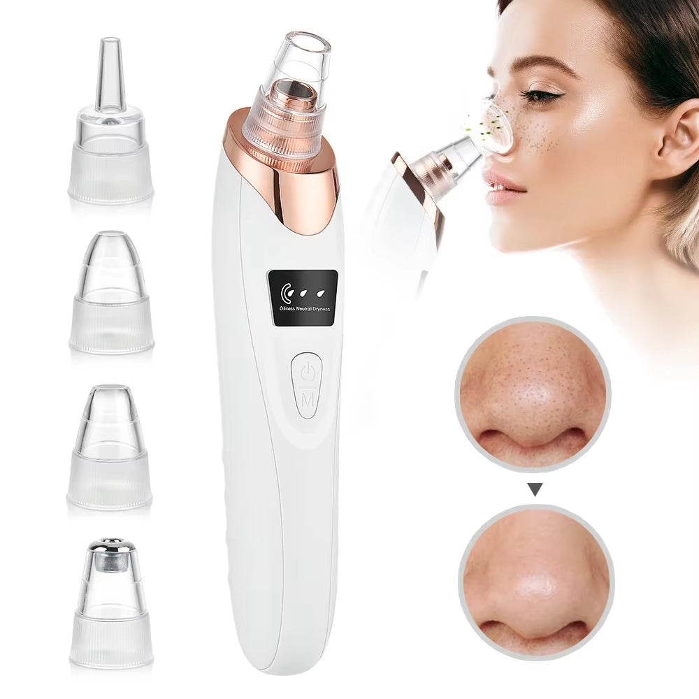 Electric Blackhead Remover Vacuum and Pore Cleaner