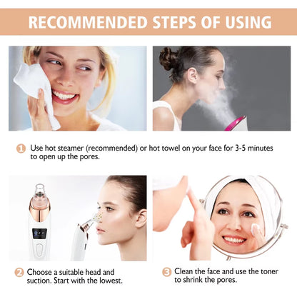 Electric Blackhead Remover Vacuum and Pore Cleaner