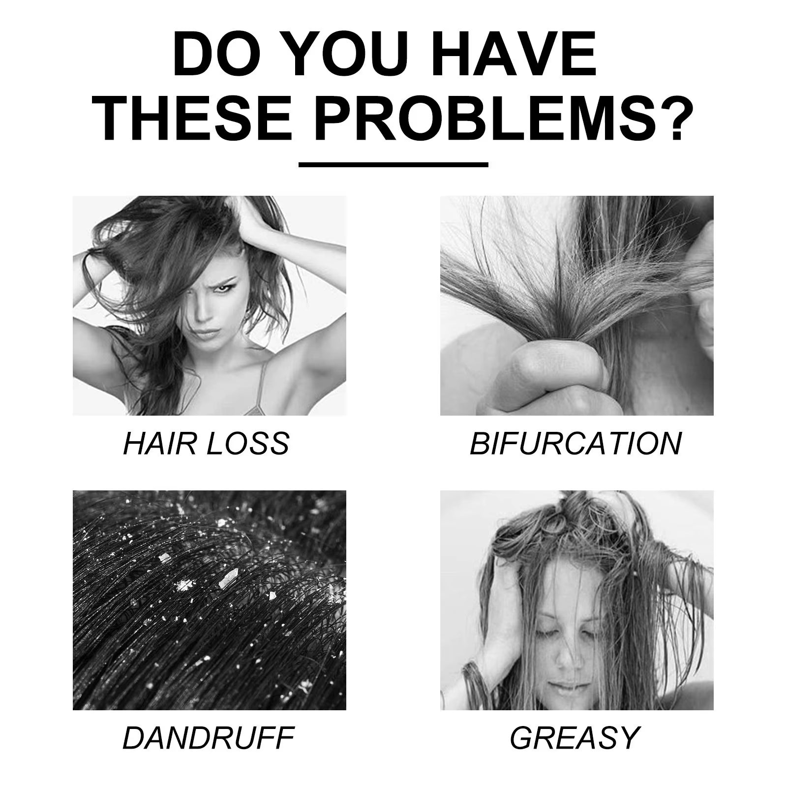 Scalp Cleansing Shampoo anti Hair Loss Itch Remove Dandruff Oil Control Repair Moisturizing Root Treatment Hair Growth Shampoo